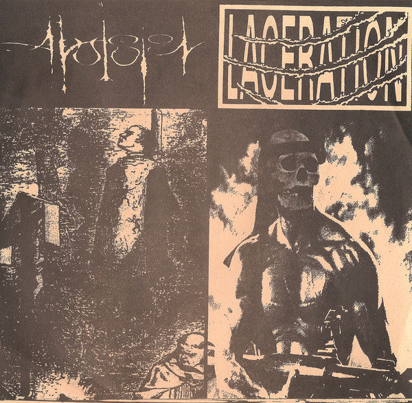Avulsion / Laceration (2) : Avulsion / Laceration (7")