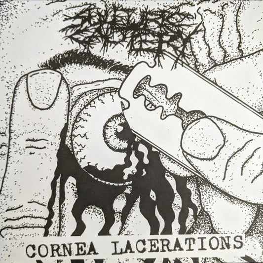 Sulfuric Cautery : Cornea Lacerations (7")