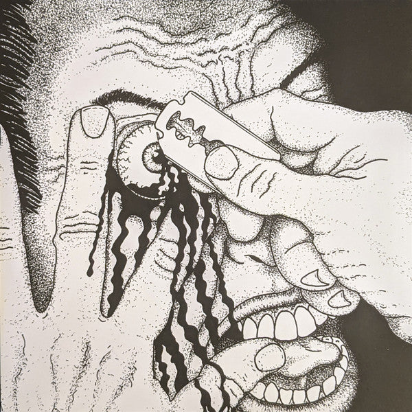 Sulfuric Cautery : Cornea Lacerations (7")