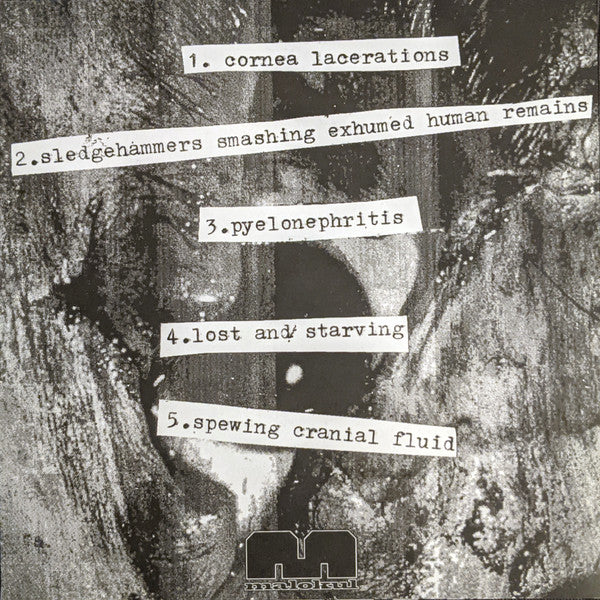 Sulfuric Cautery : Cornea Lacerations (7")