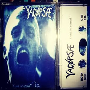 Yacopsae - "Krank Ist Normal" cassette