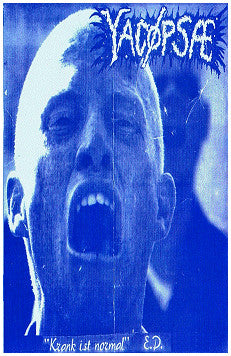 Yacopsae - "Krank Ist Normal" cassette